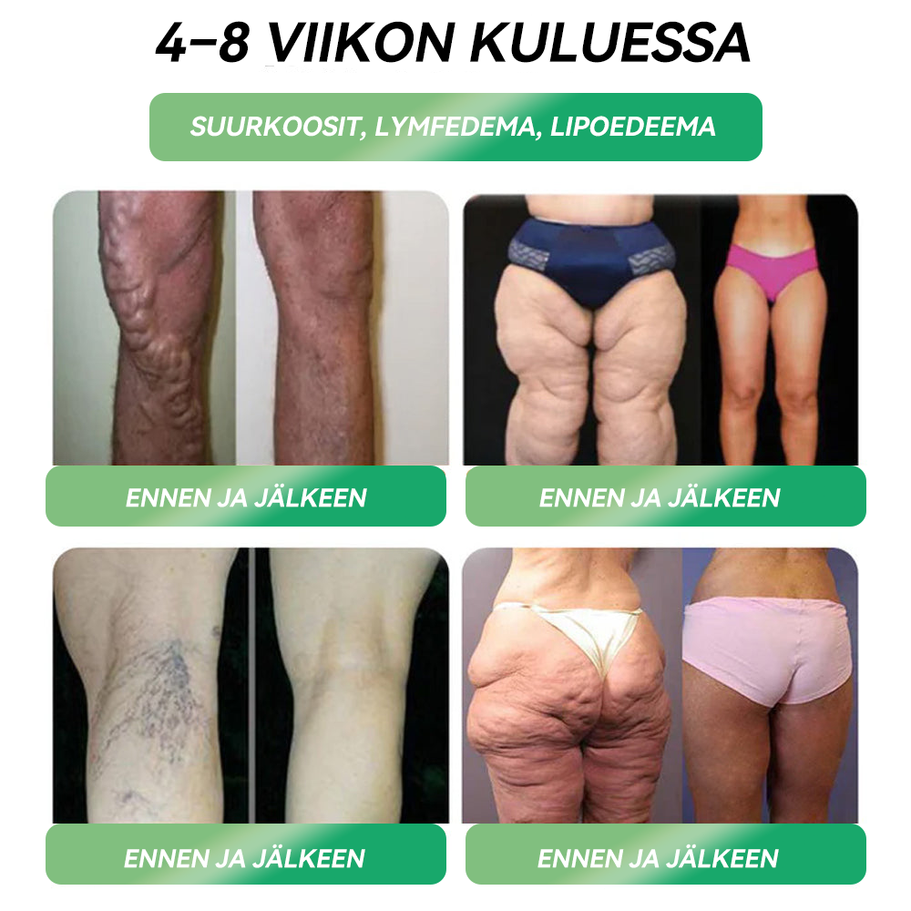 𝐒𝐓𝐃𝐄𝐈® 𝐆𝐋𝐏-𝟏 𝐒uun kautta otettava liuos 🎃🚀